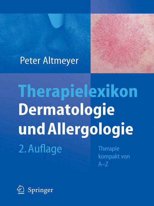 Title details for Therapielexikon Dermatologie und Allergologie by Peter Altmeyer - Available